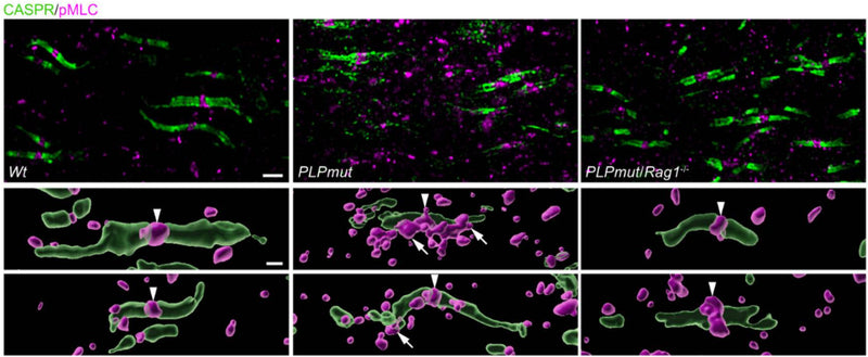 Representative immunofluorescence detection and IMARIS Z-stack surface rendering of CASPR (cat. 75-001, 1:1000) and pMLC in the optic nerves of 12-month-old Wt, PLPmut, and PLPmut/Rag1−/− mice. pMLC is localized at normal appearing nodes of Ranvier (arrowheads). In PLPmut mice, paranodal domains with irregularly small diameters are surrounded by additional pMLC aggregates (arrows). Image from publication CC-BY-4.0. PMID:37903797
