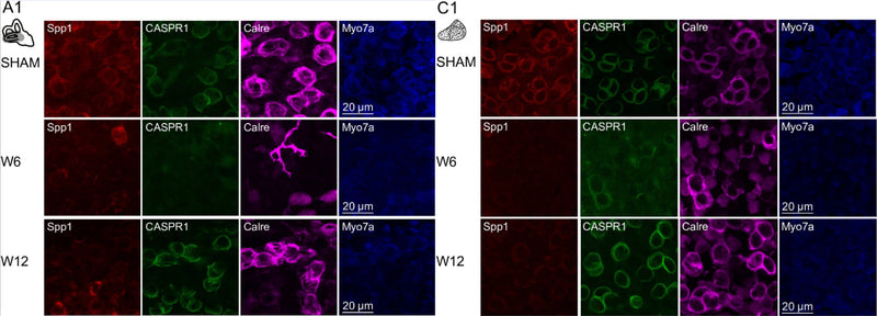 Immunolabelling of type I HC (Spp1 + and CASPR1+(cat. 75-001, 1:400)), type II HC (Calre +), or all HC (Myo7a) for the SHAM, IDPN W6 and IDPN W12 mouse groups in the central ampulla of the horizontal canal (A1) and central utricular maculae (C1). Image from publication CC-BY-4.0. PMID:38019267