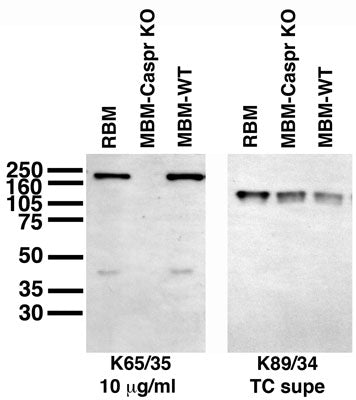 Immunoblot on adult rat brain membrane (RBM), and adult mouse brain membranes (MBM) from Caspr knockout (Caspr KO) and wild-type (WT) mice. Caspr KO sample courtesy of Drs. Ido Horresh and Ori Peles, The Weizmann Institute of Science.