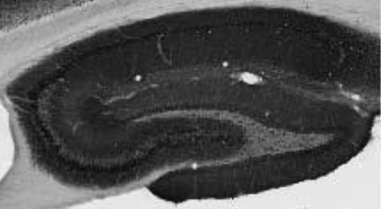 Adult rat hippocampus immunohistochemistry.