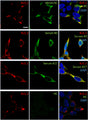  Binding of serum samples 1, 3, 27, healthy control (HC) serum and a commercial antibody against the according Kv channels to transfected HEK293 cells. Cells were transfected with human Kv1.2 and stained with a Kv1.2 antibody (Cat. 75-008, 1:200; red). Binding of patient serum was visualized with anti-human-IgG-Cy3 antibody (green). Image from publication CC-BY-4.0. PMID:38665908