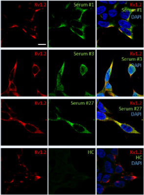 Anti-Kv1.2 K+ Channel Antibody