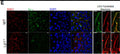 Left, 63× images of Kv1.2 immunoreactivity at CA3 Axonal Initial segments in WT (top panels) and Lgi1−/− (bottom panels). Scale bar = 10 μm. Right, detail of a CA3 pyramidal neuron AIS in WT (top panels) and Lgi1−/− (bottom panels). 