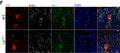 63× images showing no differences in Kv1.2 IR at the AIS of PV+ interneurons. Scale bar = 10 μm (G) Cumulative probability plots of Kv1.2 immunoreactivity at individual AIS of WT (black squares) and Lgi1−/− (red circles) CA3 pyramidal neurons