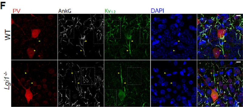 63× images showing no differences in Kv1.2 IR at the AIS of PV+ interneurons. Scale bar = 10 μm (G) Cumulative probability plots of Kv1.2 immunoreactivity at individual AIS of WT (black squares) and Lgi1−/− (red circles) CA3 pyramidal neurons