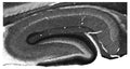 Adult rat hippocampus immunohistochemistry.