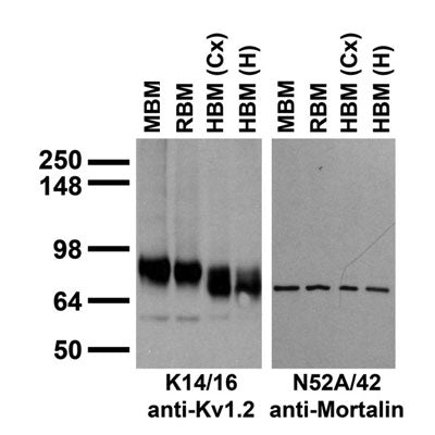 Immunoblot on membranes from whole rat (RBM) and mouse (MBM) brain and from human cerebral cortex [HBM(Cx)] and hippocampus [HBM(H)].