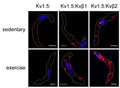 Representative proximity ligation images showing positive sites of interaction (red) between Kv1.5 (75-011, 1:50) and Kvβ1, and Kv1.5 and Kvβ2 in coronary arterial smooth muscle cells from sedentary and exercised mice. Singly labelled cells for Kv1.5 are shown as a control. DAPI nuclear stain is shown in blue. Image from publication CC-BY-4.0. PMID:38978788