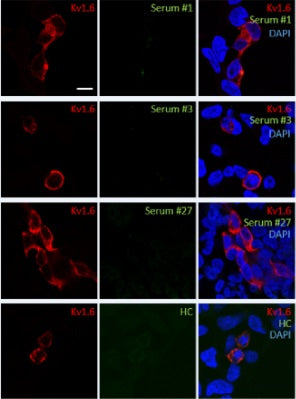 Anti-Kv1.6 K+ Channel Antibody