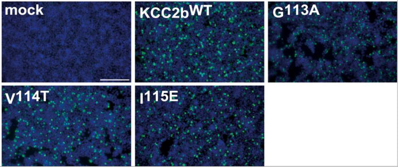 HEK-293 cells were transiently transfected with rnKCC2bWT or rnKCC2 variants with mutations in the chloride-binding site 1. Immunocytochemistry was used to monitor the transfection rate of the rnKCC2 variants (cat. 75-013, 1:1000; green) and cell staining by DAPI (blue). Image from publication CC-BY-4.0. PMID:37625593
