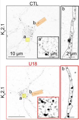 Representative super-resolution Airyscan images taken at a focal plane near the PM of CTL (black) and U18-treated (red) neurons fixed and immunolabeled for KV2.1 (cat. 75-014). Image from publication CC-BY-4.0. PMID:37507375