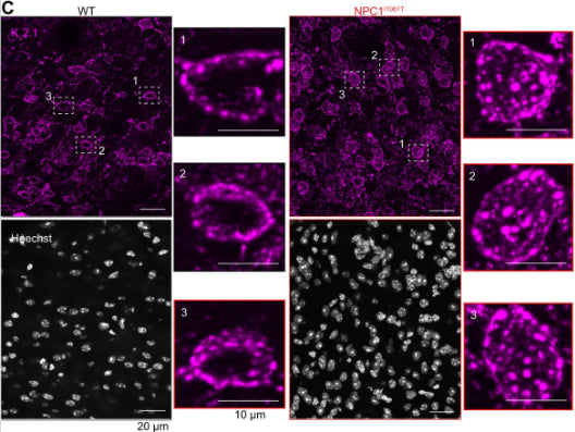 Representative maximum intensity projections from Wild-Type (WT) (black) and NPC1I1061T (red) cortical sagittal sections stained with Hoechst and immunolabeled for KV2.1 (cat. 75-014, 10ug/ml). Right, quantification of Kv2.1 total intensity, cluster size and cluster density of WT (black) and NPC1I1061T (red) neurons in the soma region. Image from publication CC-BY-4.0. PMID:37507375