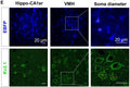 Representative images of astrocytes labeled by AAV5-GfaABC1D-EBFP and neurons labeled by Kv2.1 (Cat. 75-014, 1:100) in the hippocampal CA1sr and VMH. The measurement method of soma diameter is shown on the right. The yellow