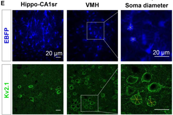 Representative images of astrocytes labeled by AAV5-GfaABC1D-EBFP and neurons labeled by Kv2.1 (cat. 75-014, 1:100) in the hippocampal CA1sr and VMH. The measurement method of soma diameter is shown on the right. The yellow dashed lines show the three randomly selected branches of each cell. Image from publication CC-BY-4.0. PMID:38137092