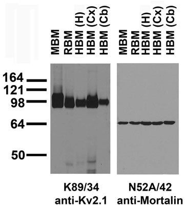 Immunoblots on brain membranes prepared from whole rat (RBM) and mouse (MBM) brain, and from human hippocampus [HBM(H)], cerebral cortex [HBM(Cx)] and cerebellum [HBM(Cb)].