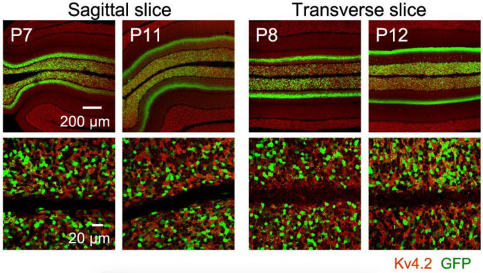Confocal images of mouse cerebellar sagittal (left) or transverse (right) slices stained with a Kv4.2 antibody (cat. 75-016; red). AAV-GABRα6-GFP (green) was injected on the indicated postnatal days. Image from publication CC-BY-4.0. PMID:37095324