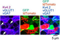 Confocal images showing tdT- (red) and GFP-positive GC dendrites (green) included in glomeruli, which are visualized by staining with three antibodies, Kv4.2 (Cat. 75-016; purple in left panels or blue in right panels), vGLUT1 (blue), and vGAT (blue). Glomeruli are shown with arrows. Image