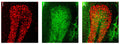 Coronal sections of rat cerebellum, stained with human patient autoantibodies (I, red) and anti-VAChT (J, green,  Cat no 75-020, 1:300). Colocalization was not observed when mixing the anti-VAChT with the autoantibodies (merge K, red labeling + green labeling),