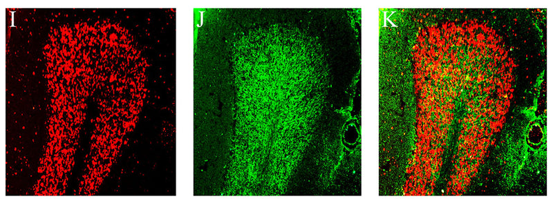 Coronal sections of rat cerebellum, stained with human patient autoantibodies (I, red) and anti-VAChT (J, green, Cat no 75-020, 1:300). Colocalization was not observed when mixing the anti-VAChT with the autoantibodies (merge K, red labeling + green labeling), In addition, autoantibody labeling was identified with Cy3 red labeling, while the antibodies were identified with Alexa488 green labeling.  CC-BY-4.0 PMID: 37383228 