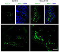 Immunolabeling of Nav1.1 (Cat. 75-023, 1:250) showing an increased expression in the Dorsal Root Ganglia of NaV1.7 knockout mice when compared to control mice. Image