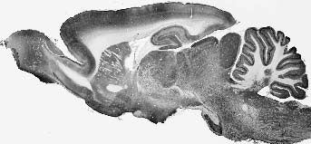 Adult rat whole brain immunohistochemistry.