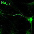 Immunolabeling of of cultured AnkG knockout mouse neurons identifying NaV 1.2 (Cat. 75-024, 1:500). Image from publication. PMID: 39415847