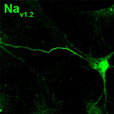 Immunolabeling of of cultured AnkG knockout mouse neurons identifying NaV 1.2 (Cat No 75-024, 1:500). Image from publication. PMID: 39415847