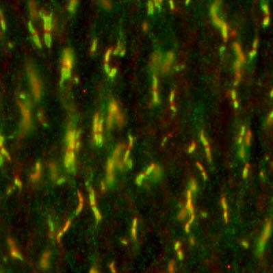 Adult rat optic nerve immunofluorescence staining L11A/41 (5 μg/ml)=red Rabbit anti-Caspr=green Image courtesy of Dr. Matthew Rasband.