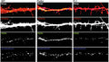 Immunofluorescences against PSD95 cat. 75-028) and Synaptophysin in wild-type, FL, and FL1-injected mouse neurons. Image from publication CC-BY-4.0. PMID:37957716