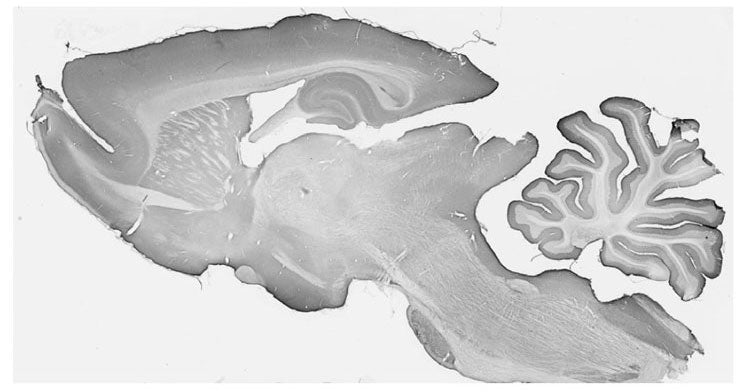 Adult rat brain immunohistochemistry.