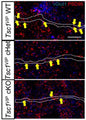 Single confocal images of wildtype (top), heterozygote (middle) and mutant (bottom), showing the colocalization of vGlut1+ boutons (blue) and PSD95+ clusters (Cat. 75-028) onto VIP+ proximal dendrites (white outline) (yellow arrows) at P45. Image from publication CC-BY-4.0. PMID:38201256