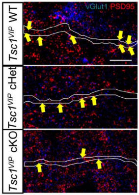 Single confocal images of wildtype (top), heterozygote (middle) and mutant (bottom), showing the colocalization of vGlut1+ boutons (blue) and PSD95+ clusters (cat. 75-028ed) onto VIP+ proximal dendrites (white outline) (yellow arrows) at P45. Image from publication CC-BY-4.0. PMID:38201256