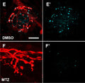 Fluorescence images showing sensory nerve endings with postsynaptic MAGUK+ (Cat. 75-029,1:200) puncta in Ins:epNTR-mCherry expressing Tg (tubb2b:dsred) zebrafish larvae treated with DMSO (E,E’) and MTZ (F,F’) at 9 dpf. Image from