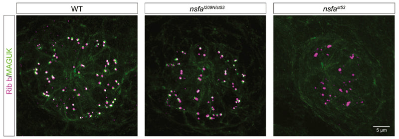 Ribbon synapses in WT zebrafish larvae as well as nsfaI209N/st53 mutants, and nsfast53 mutants. A pan-MAGUK antibody (cat. 75-029, 1:500; green) was used to label the postsynaptic density of afferent terminals, and ribbons were visualized with anti-Ribeye b antibody (magenta). Image from publication CC-BY-4.0. PMID:37027300