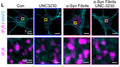 Representative confocal images of control and α-Syn fibril-treated mouse neurons stained with IP3R1 (Cat. 75-035; magenta) and MAP2 (cyan) with or without treatment of 100 nM UNC-3230. Zoomed-in images show only IP3R1. Image from publication CC-BY-4.0.