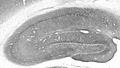 Adult rat hippocampal immunohistochemistry.