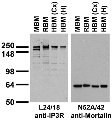 Immunoblots on brain membranes prepared from whole rat (RBM) and mouse (MBM) brain, and from human cerebral cortex [HBM(Cx)] and hippocampus [HBM(H)].