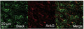 Confocal microscopy images obtained from coronal brain slices of c57Bl/6 mice with immunofluorescent labeling of Slack (Cat. 75-051, green, 1:100) and Ank G (red) in neocortex layer 5. Image from publication, CC-BY-4.0. PMID: 38289338.