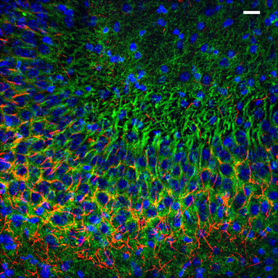 Immunolabeling of postnatal 14 mouse CA3 specifically labeling PSD93 (Cat no 75-057, 1:400, green) and Ankyrin G(red). DNA labeled with DAPI. Mice were transcardially perfused with ice-cold 4% paraformaldehyde in PBS, then brain removed and postfixed overnight. The 50uM slices were floating sections. Objective 25x, scale bar = 20um. Images kindly provided by Jorge Ramirez-Franco and Oussama El Far, Aix-Marseille Université and INSERM. 