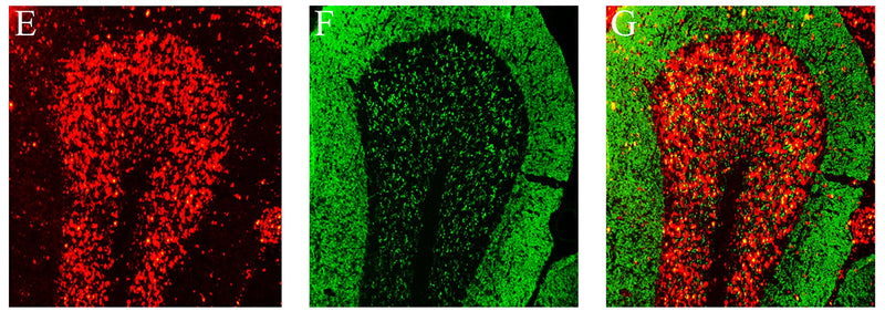 Coronal sections of rat cerebellum, stained with human patient autoantibodies (I, red) and anti-VAChT (J, green, Cat no 75-020, 1:300). Colocalization was not observed when mixing the anti-VAChT with the autoantibodies (merge K, red labeling + green labeling), In addition, autoantibody labeling was identified with Cy3 red labeling, while the antibodies were identified with Alexa488 green labeling.  CC-BY-4.0 PMID: 37383228 