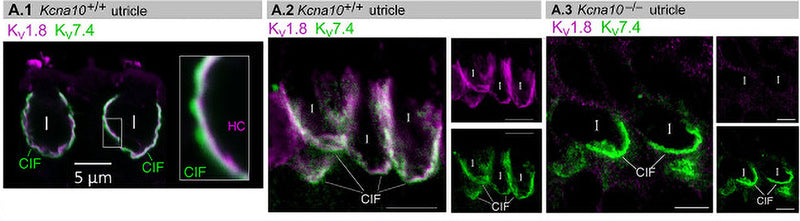 Adult mouse utricle sections. KV7.4 antibody (Cat no 75-082, 1:200, green) labeled calyces on two KV1.8-positive type I HCs (A.1), four KV1.8-positive type I HCs (A.2), and two KV1.8-negative type I HCs from a Kcna10–/– mouse (A.3). Image from publication. CC-BY-4.0 PMID: 39625061