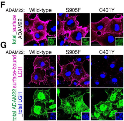 Cell-surface-expressed ADAM22 (F, magenta) and cell-surface-bound LGI1 (G, magenta) were live-labelled. After fixation and permeabilization, ADAM22 (total) was stained (cat. 75-083; green), with nuclear DNA (blue, F and upper panel in G). ADAM22 S905F is on the cell surface binds to LGI1 as the wild-type. When ADAM22 C401Y is expressed, no cell-surface-bound LGI1 is detected. White squares are total expression of ADAM22 (F) and LGI1–FLAG (lower panel in G, blue). CC-BY-4.0. PMID:37953841