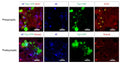 Swollen dystrophic neurites of 5xFAD; Thy1-YFP mice at six months of age were immunostained for synaptotagmin-1 (STG1), and Shank2 (Cat. 75-088) to co-stain pre and postsynaptic compartments, respectively. Neurofilament (NF) was used to label dystrophic neurites. Image from publication CC-BY-4.0. Cat. 75-088), and Map2. Image from publication CC-BY-4.0. PMID:37667395