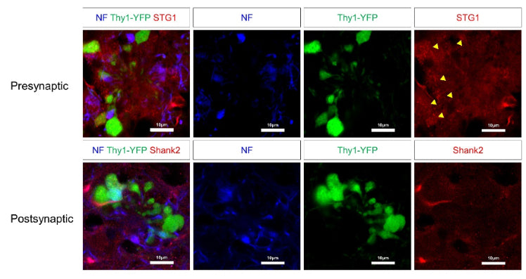 Swollen dystrophic neurites of 5xFAD; Thy1-YFP mice at six months of age were immunostained for synaptotagmin-1 (STG1), and Shank2 (cat. 75-088) to co-stain pre and postsynaptic compartments, respectively. Neurofilament (NF) was used to label dystrophic neurites. Image from publication CC-BY-4.0. PMID:37667395