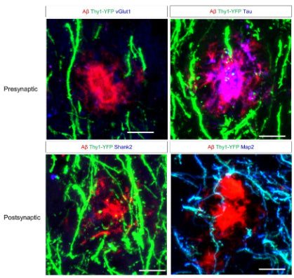 Lack of swollen dystrophic neurites in the molecular layers of the dentate gyrus rich in YFP-positive dendrites of dentate granule neurons at seven months of age of 5xFAD; Thy1-YFP mice. Sections were immunostained for Aβ, and presynaptic markers such as vesicular glutamate transporter 1 (vGlut1), and Tau, and postsynaptic markers such as Shank2 (cat. 75-088), and Map2. Image from publication CC-BY-4.0. PMID:37667395