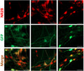 Immunostaining for GFAP, NR2B (Cat. 75-101, 1:100), and TH expression indicates proper differentiation of six-week-old neuronal cultures. Image from publication CC-BY-4.0. PMID:37739965