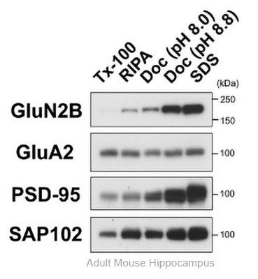 Anti-GluN2B/NR2B Glutamate Receptor Antibody