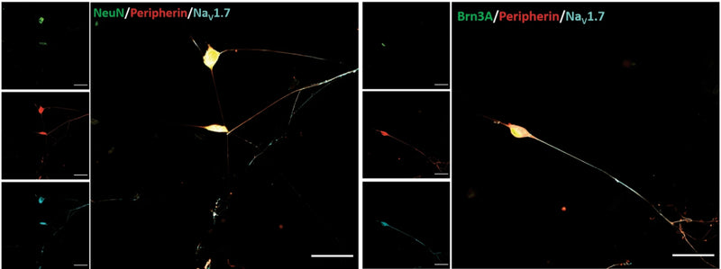 Induced pluripotent stem cell-derived sensory neurons (iPSC-SNs) stained positively for peripherin (a marker of peripheral neurons), Brn3a (a marker of sensory neurons48), NeuN (a marker of neuronal nuclei), and NaV1.7 (cat. 75-103, 1:250). Image from publication CC-BY-4.0. PMID:34930944