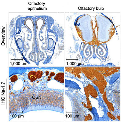 Immunostaining of olfactory bulb and olfactory epithelium of normosmic mice. The 4-um section PPFE tissue was deparffinizeed with EZPrep buffer. For IHC, immunostaining was performed using Anti-NaV1.7 (Cat no 75-103, DAB-brown, 0.5 ug/ml) and counterstained with hematoxylin (blue). Image from publication, CC-BY-4.0. PMID: 38960711.