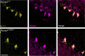 Representative confocal sections of lamina adjacent to the Purkinje cell layer from Kcna1V408A/+ and control cerebellar cortex, labelled for KV1.1 (Cat. 75-105, 1:1000; yellow) and PSD-95 (centre, magenta). Right, merged image. Image from publication CC-BY-4.0. PMID: 37408217